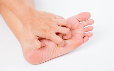 Athlete’s Foot